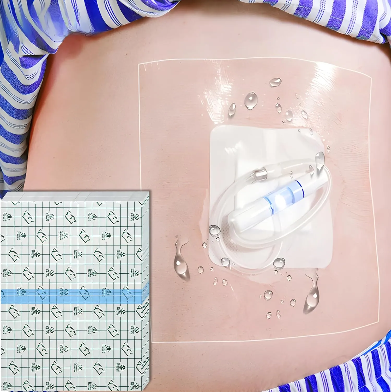 Dialysis Catheter Shower Cover | 6x10 Inch Shower Protector for Central Line Wound Dressing Large Waterproof Bandages Chemo Port Chest Catheter Covers for Showering (Pack of 50)