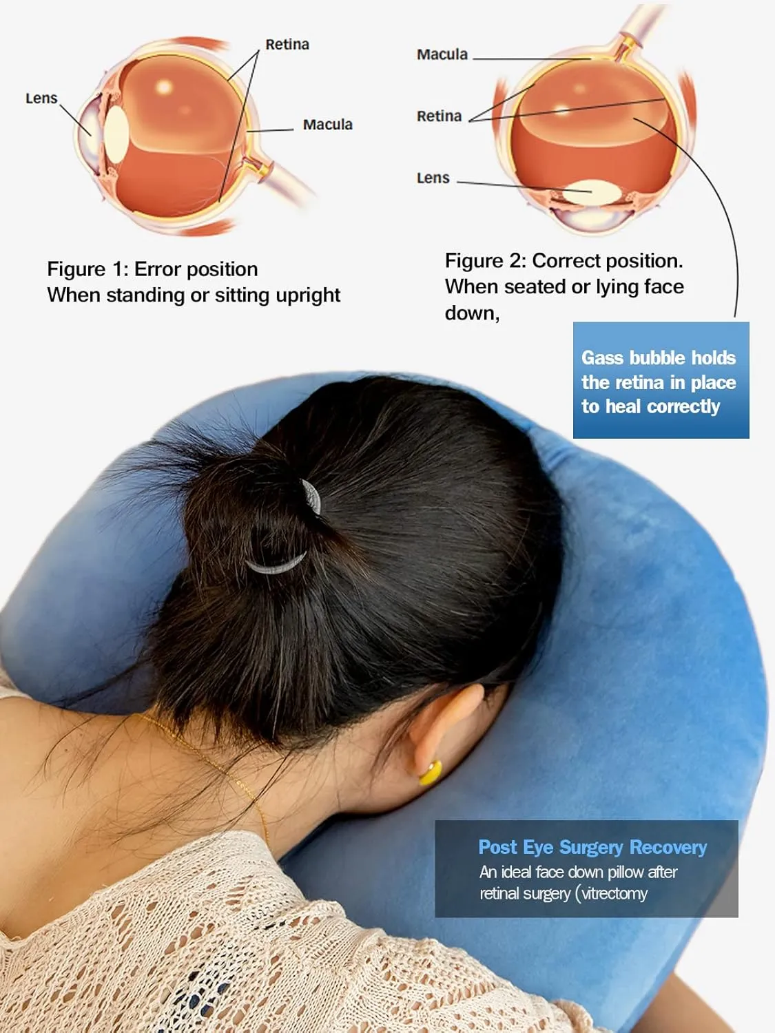 Face Down Pillow After Eye Surgery, Adjustable Height Prone Prone Pillow Face Down Sleep, Retina Lying Pillow, Vitrectomy Macular Hole Retinal Detachment Recovery Equipment Eye Surgery Support